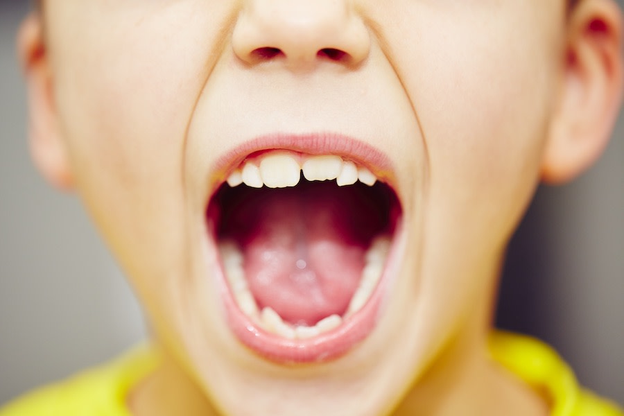 Aligner Zahnbegradigung bei Milchzähnen?