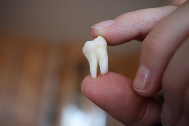 Denti: funzione, tipi e anatomia
