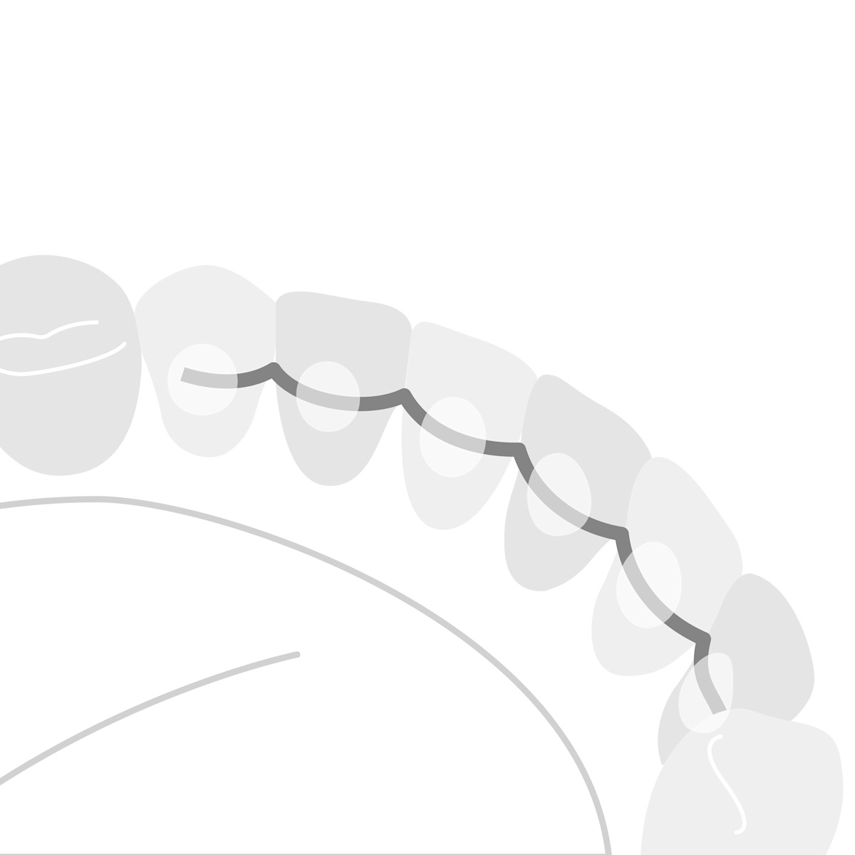 Illustration-Product-Fixed-Retainer-close-up_SEO_v1_800x600_all_17__