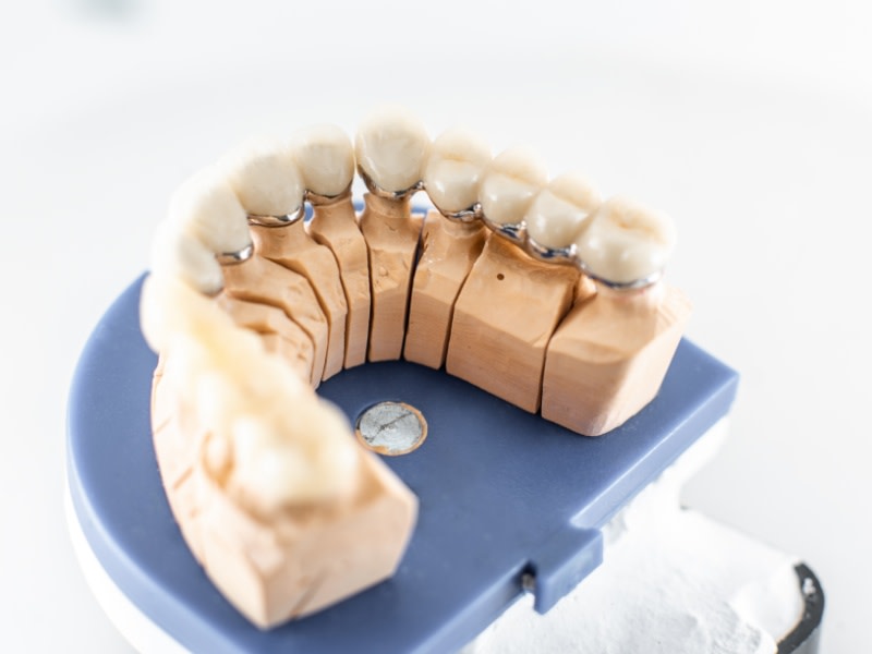 Wenn sich Deine Zähne lose anfühlen | Während der Anwendung