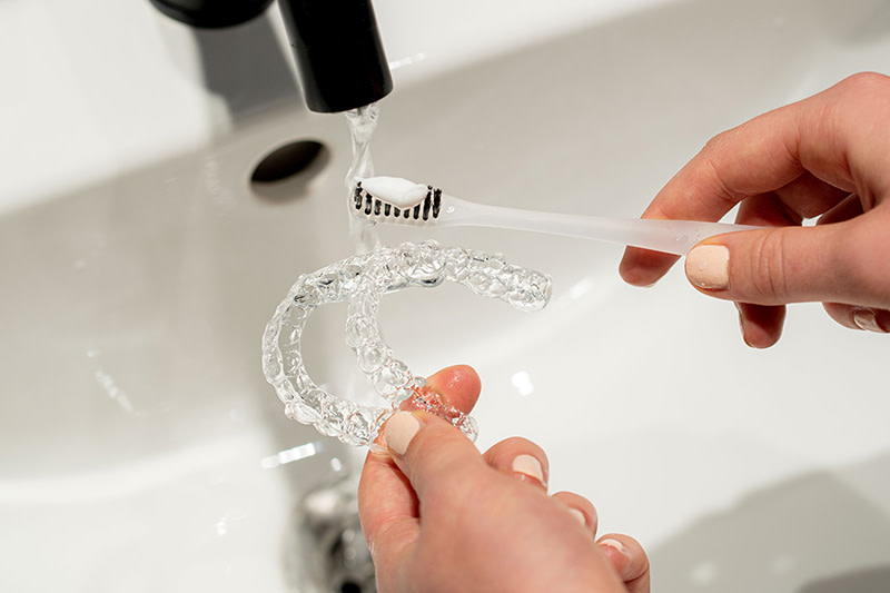 Pulire allineatori con spazzolino da denti e acqua