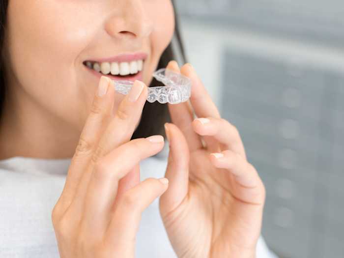 blanqueamiento dental en casa con férulas
