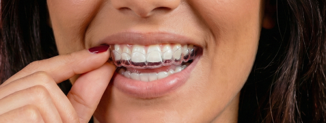 [CRO] During the treatment Impress HowItWorks Engagers 2