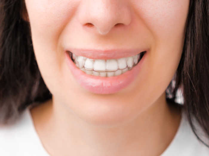 Mujer-con-ortodoncia-para-arreglar-dientes