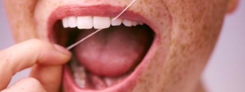 [CRO] Smile - Teeth - Dental floss - Freckles - Smile - Zoe