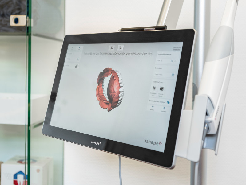 Dein Infotermin: Was passiert beim 3D-Scan?