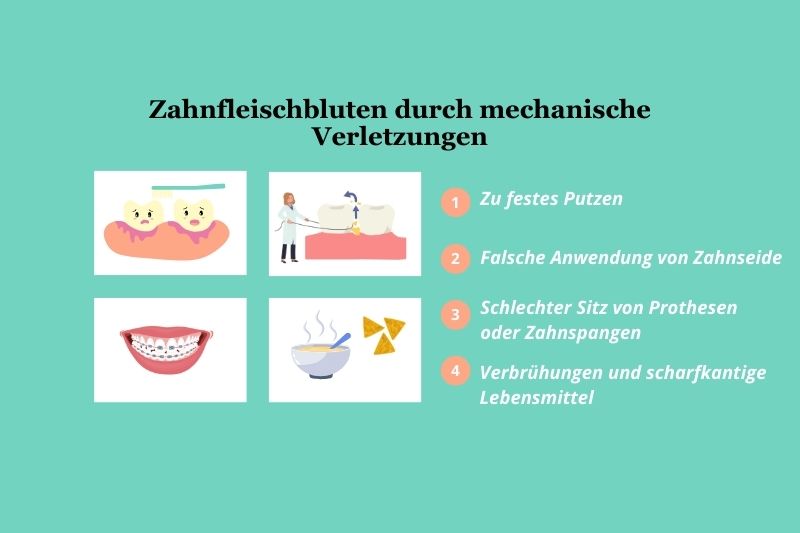Ursachen fĂŒr Zahnfleischbluten