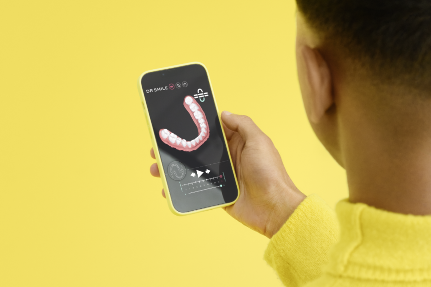 Mann, der sich einer Zahnausrichtungsbehandlung mit unsichtbaren DR SMILE-Alignern unterzieht, überprüft den Fortschritt über die App