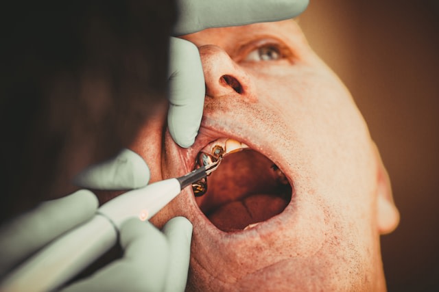 Verfaulte Zähne - wenn es kaum noch Hilfe gibt…