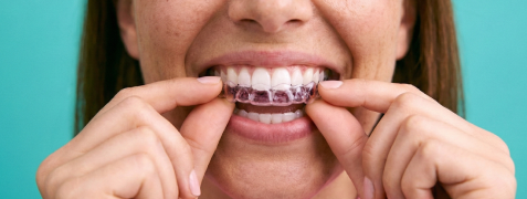 DR SMILE in de media: Plezier & Passie bij RTL4