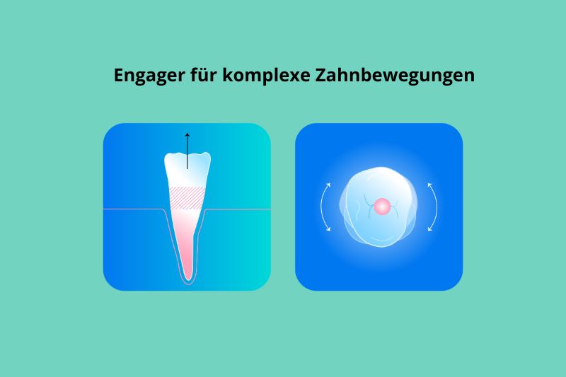 Engager für komplexe Zahnbewegungen