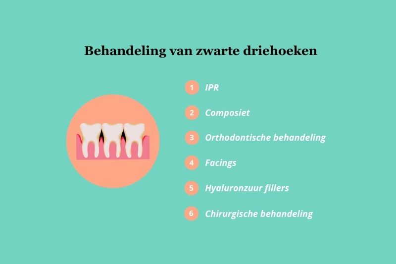 Manieren om zwarte driehoeken te behandelen