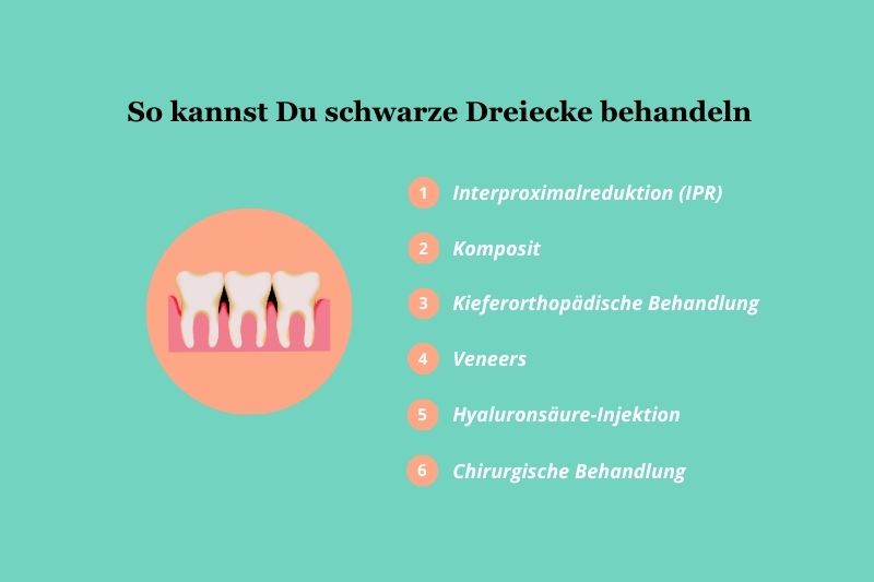 So kannst Du schwarze Dreiecke behandeln