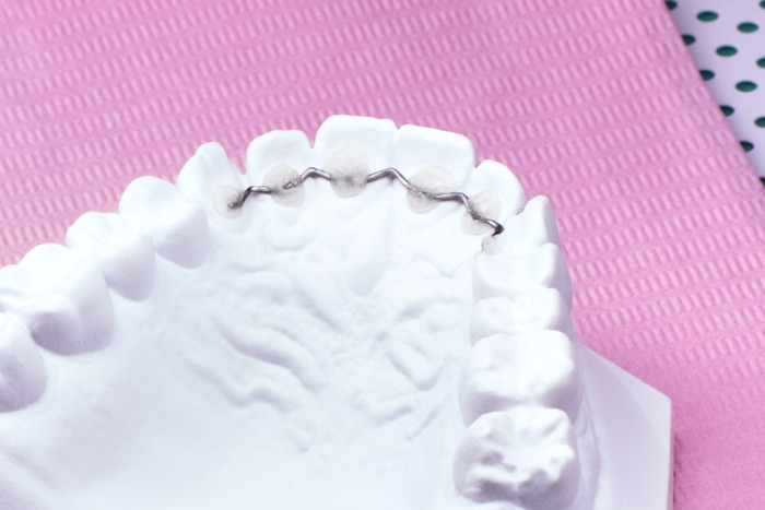 Wire-Retainer hero v2 1200x800