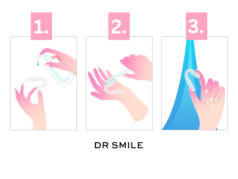 Guía paso a paso para limpiar alineadores transparentes