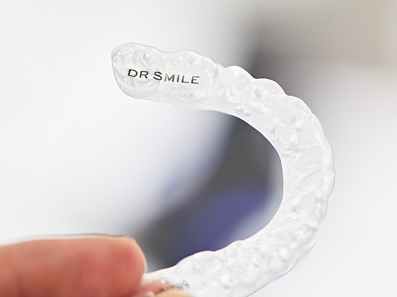 5 Gründe, warum sich eine unsichtbare Zahnschiene lohnt | DR SMILE
