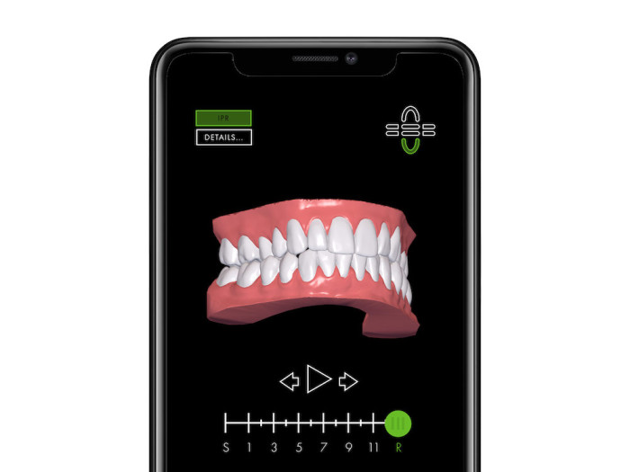 DrSmile Simulation 3D Scan