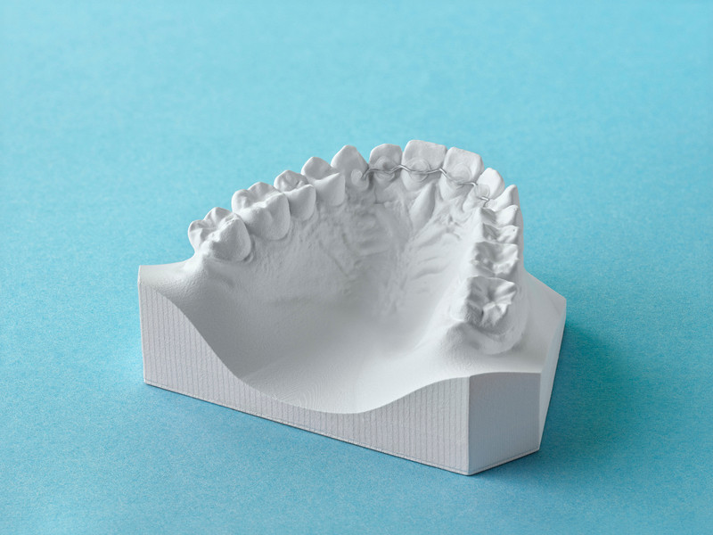 Filo di contenzione fisso DR SMILE