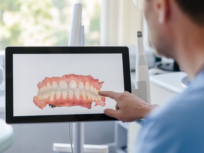 Resultado de un escáner dental 3D