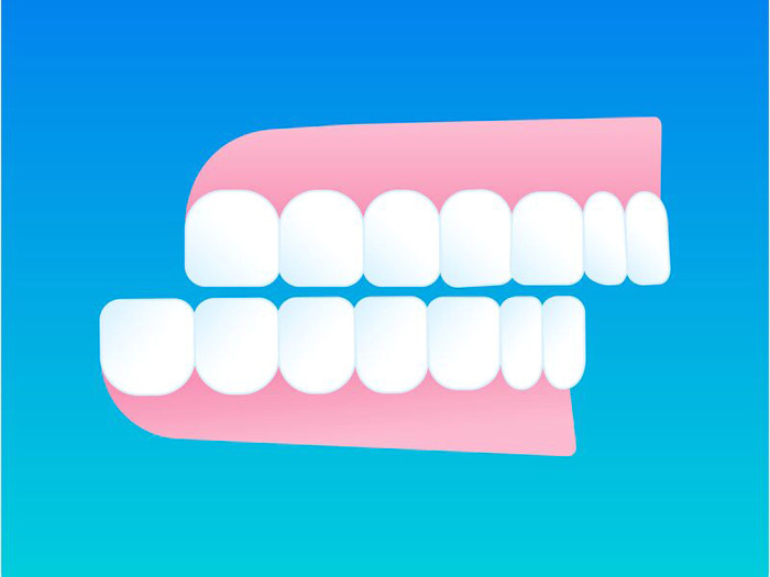 Ilustracion sobremordida