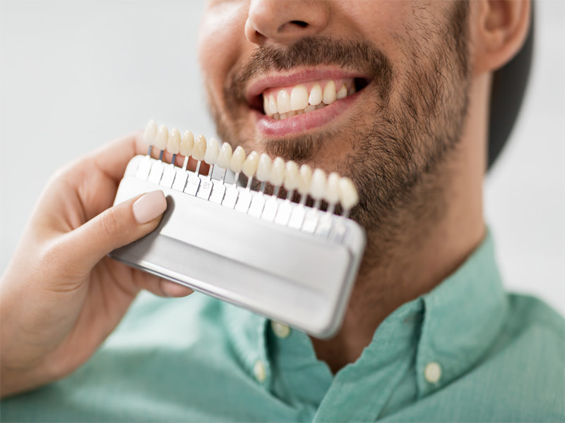 Escala de color de los dientes y hombre