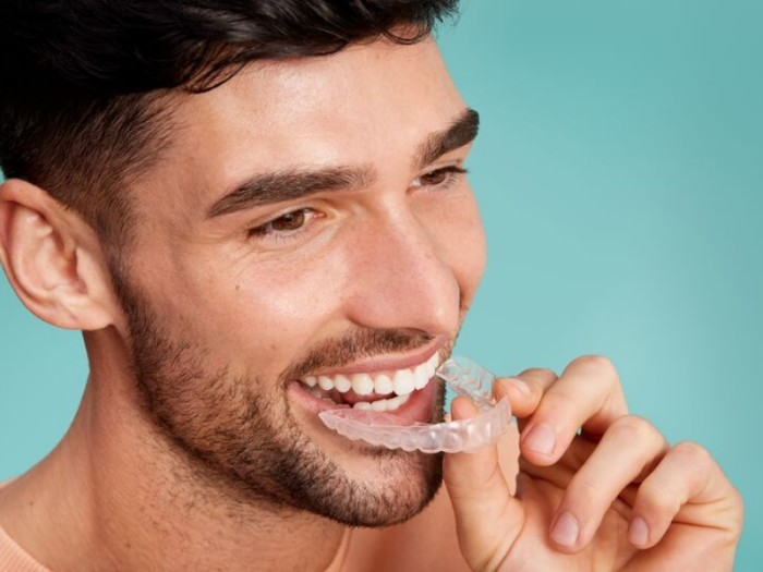 Mężczyzna stłoczone zęby nakładki ortodontyczne