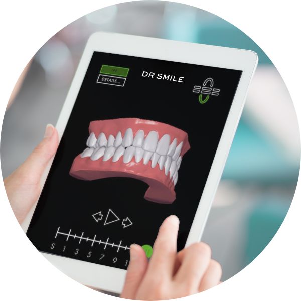 Rendu du scan 3D pour un traitement par orthodontie invisible