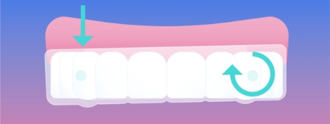 DURING - Attachment Mobile + Desktop 1