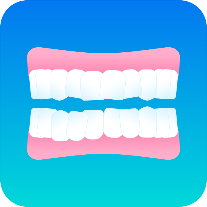 Illustrazione affollamento dentale DR SMILE