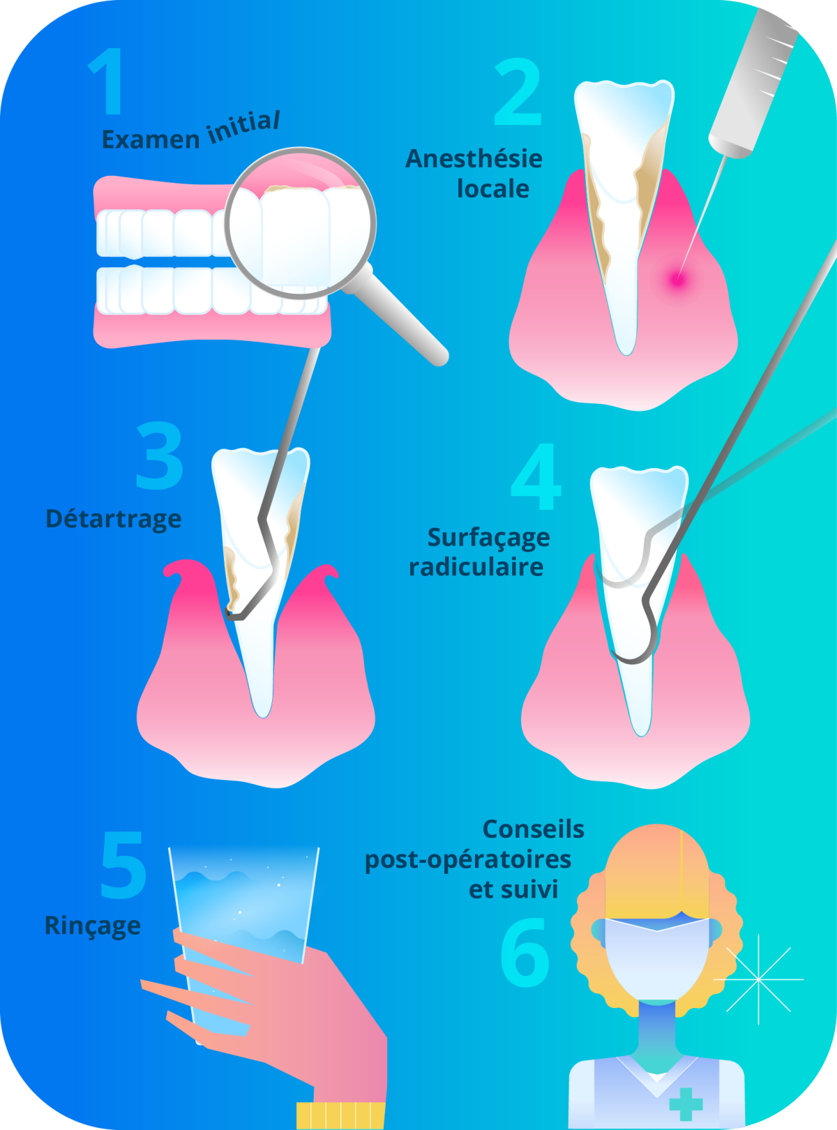 Toutes les étapes d'un curetage dentaire (avec surfaçage radiculaire) chez le dentiste