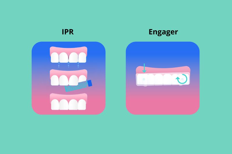 Ipr & Engager