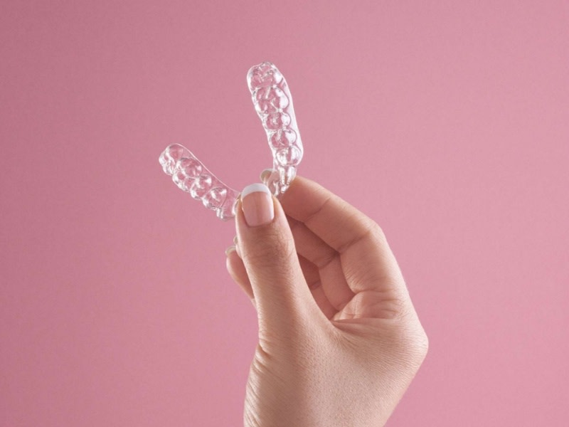 Brackets Invisibles: Que Son y Cuales Son Sus Ventajas