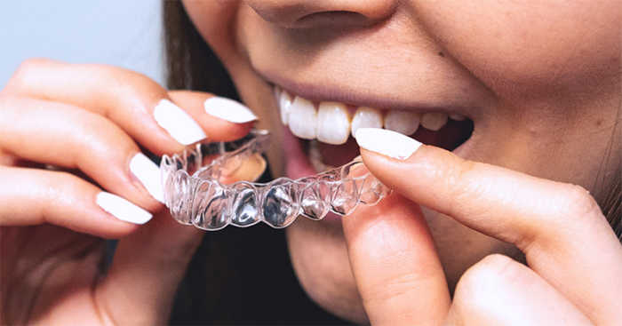 DrSmile Clear Aligner / Dental Splint