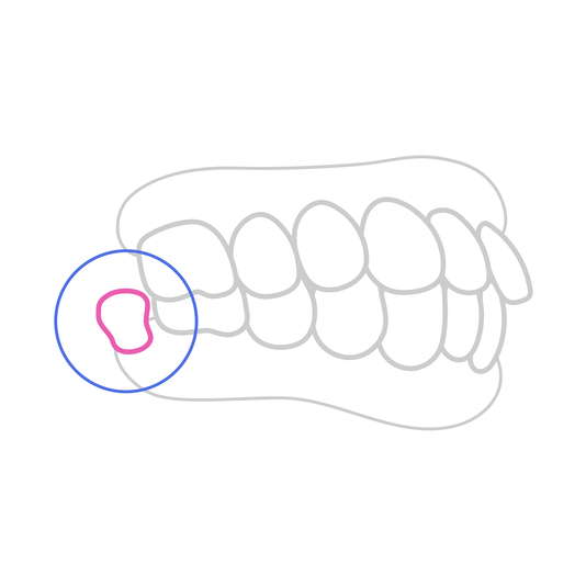 Tout savoir sur les dents de sagesse