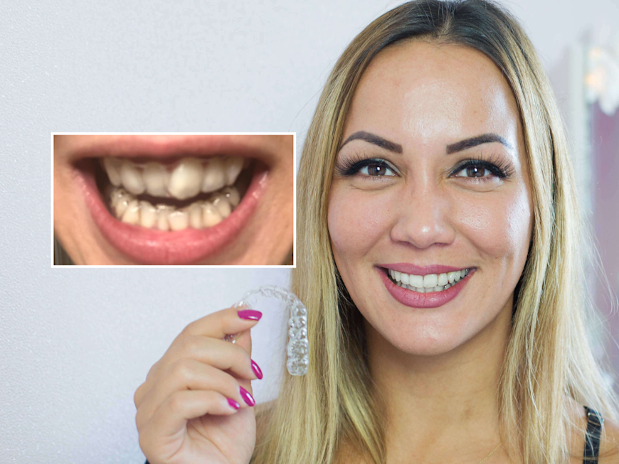 Customer-Product-before-after-format-centered___800x534_all_45__