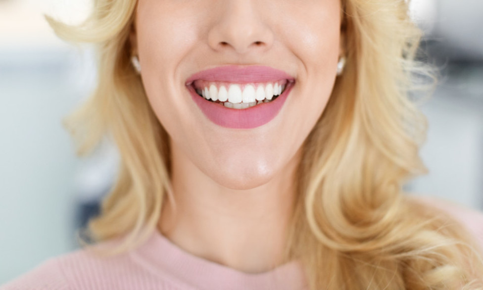 Come avere denti bianchi: guida completa per un sorriso brillante