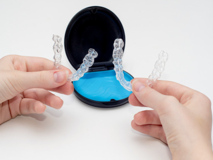 Tratamiento-con-alineadores-para-arreglar-dientes
