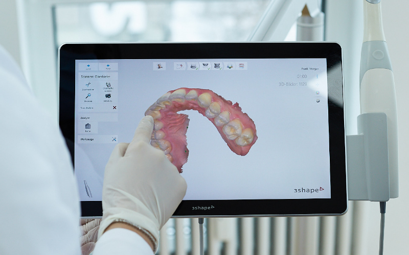 Scan 3D de la dentition d'un.e patient.e dans le cadre d'une consultation chez le dentiste