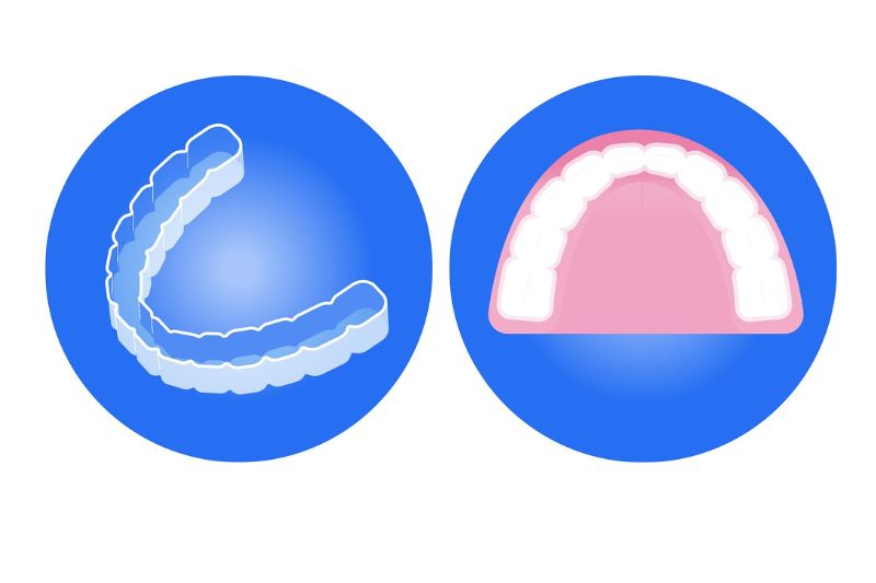 Férula de retención