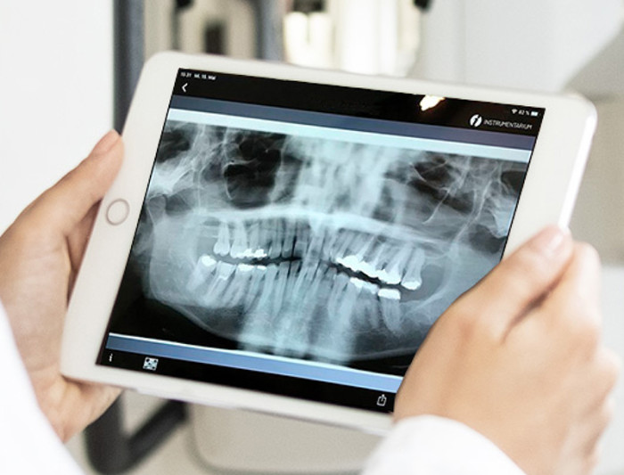 Radiografias de dientes