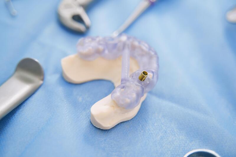 Modèle de mâchoire avec implant dentaire