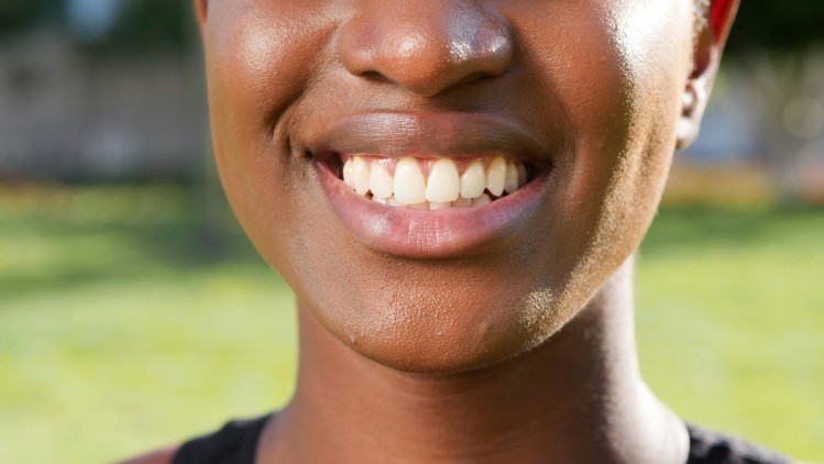 Erwachsene Frau mit verschobenen Zähnen @ pexels by kindelmedia
