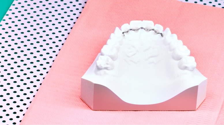 My treatment STEP 3 - Fixed retainer Desktop