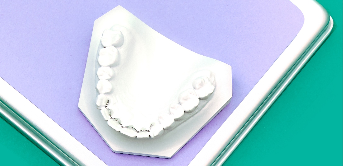 AFTER FIXED RETAINER Desktop