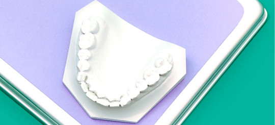 AFTER FIXED RETAINER Desktop