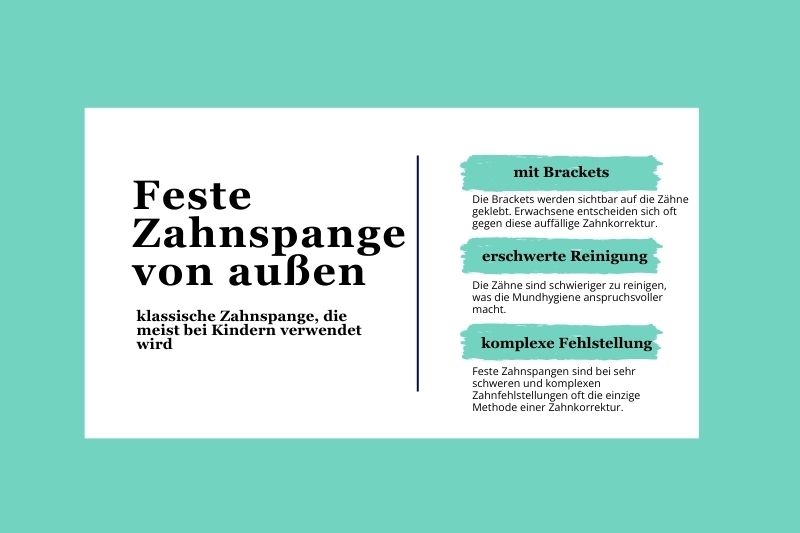Zahnspangen von innen stellen eine praktische Zahnspange für Erwachsene dar