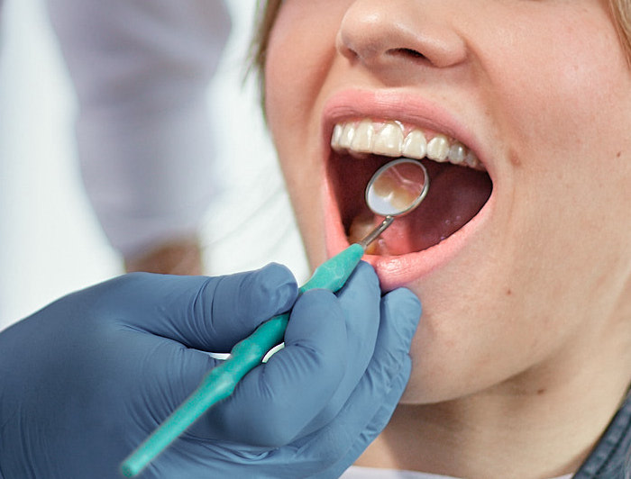 DrSmile Zahnschiene: Zahnarzt Check