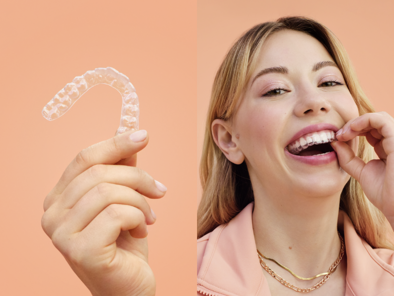 Retainer Smile Aligner