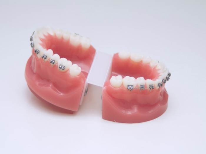 foto de dientes arreglados