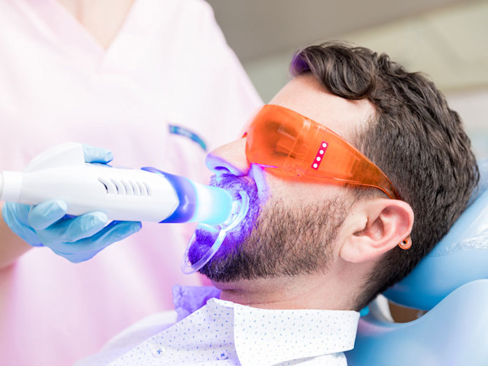 Hombre realizandose un blanqueamiento dental con luz